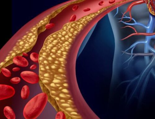 Hipercolesterolemia familiar: la enfermedad más frecuente causada por el trastorno del metabolismo del colesterol