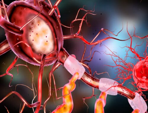 Tumor neuroectodérmico melanótico de la infancia